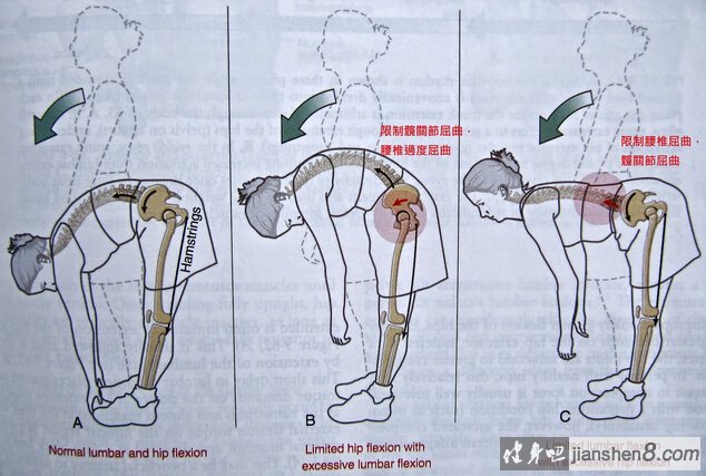 硬拉两个关键:髋关节活动度+腰椎稳定度。